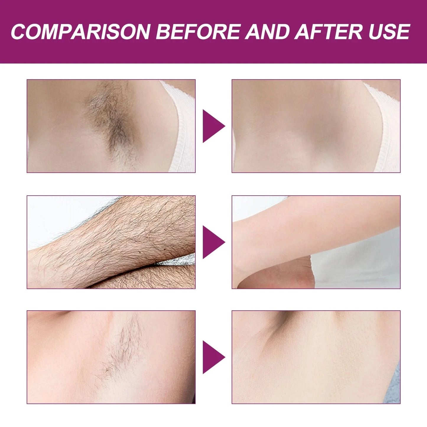 Oceaura Hair Removal Spray Painless Quick Smoothing Skin Silky Beauty Body Delay Growth Hair Removal Mist for Armpit Leg Bikini - M & M Global