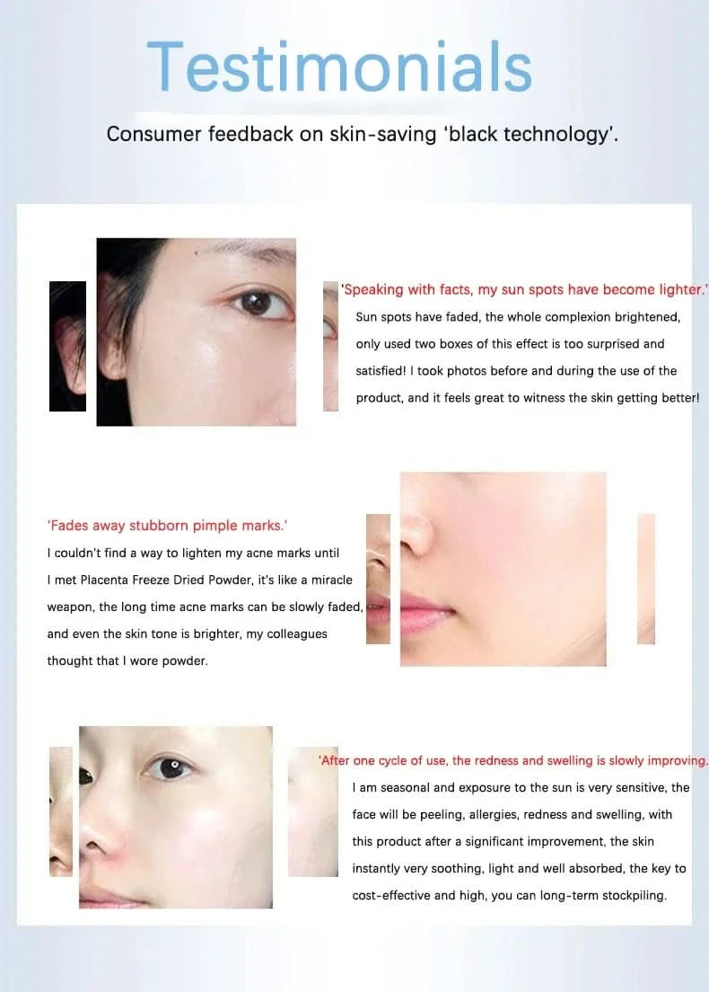 Placenta Freeze-dried Powder Essence Repair Facial Hydrating Nourishing Pore Shrinking Skin Rejuvenate Skin Care - M & M Global