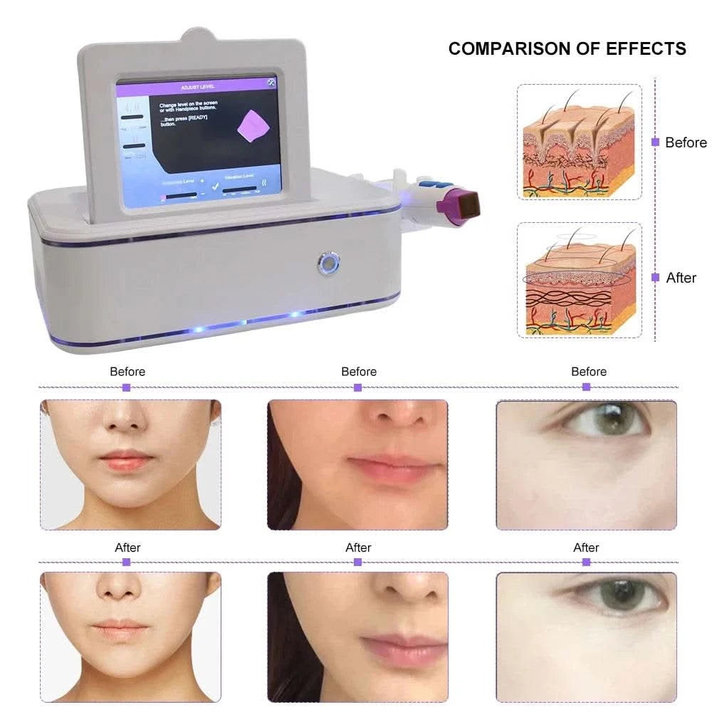 3 in 1 Skin Care Facial Lifting Fractional Skin Tightening Machine Tighten Beauty Tools Anti Aging Wrinkle Remover Device - M & M Global