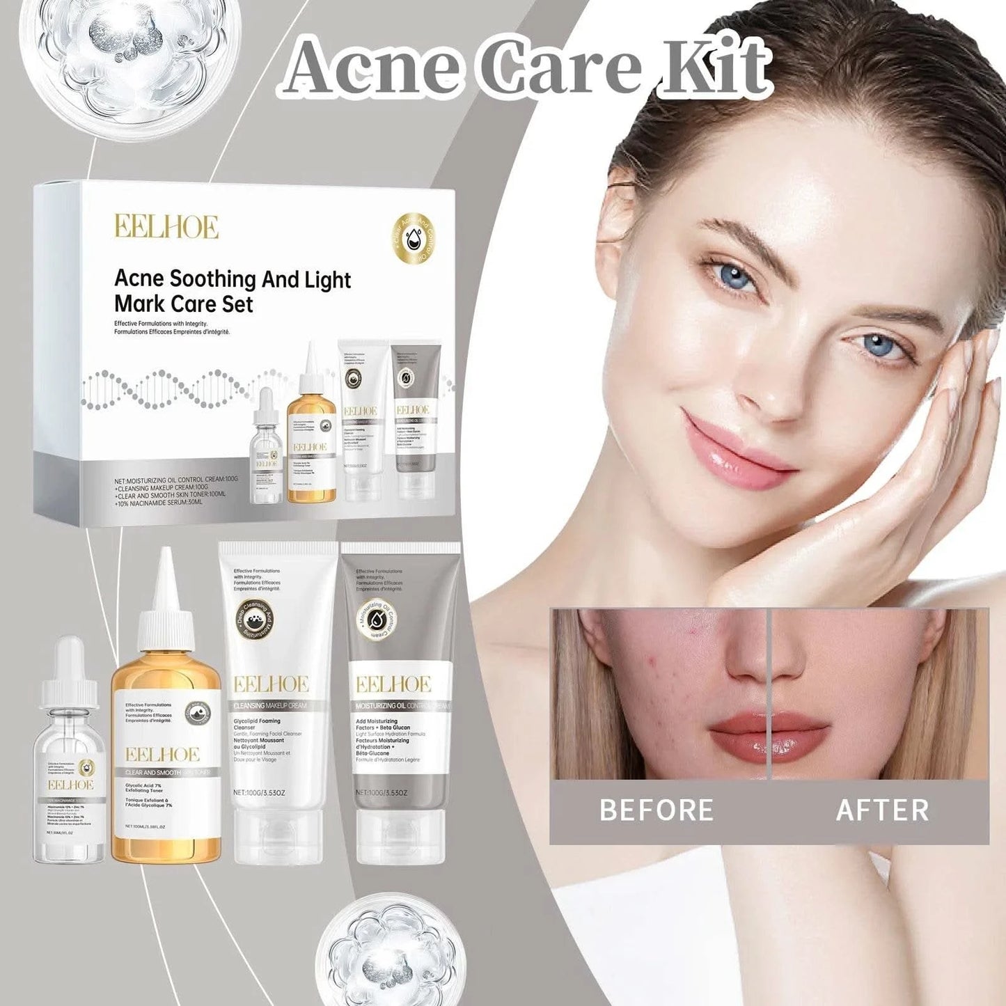 Acne Care Kit Brightening Skin Tone Fade Acne Scars Improving Skin Texture Deeply Moisturizing The Skin Facial Skincare Products - M & M Global