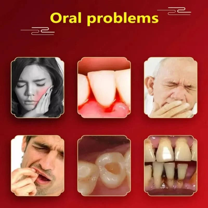 Toothache Spray Swollen Gum Relief Spray Periodontitis Treatment Cure Worms Antiseptic Mouth Tooth Toothpaste Breath Freshener - M & M Global