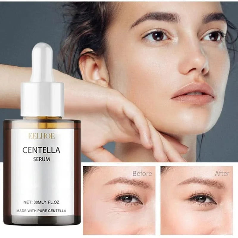 Korean Centella Asiatica Face Serum Nourish Dry Skin Smoothing Rejuvenation Skin Brightening Whitening Cream Facial Moisturizer - M & M Global