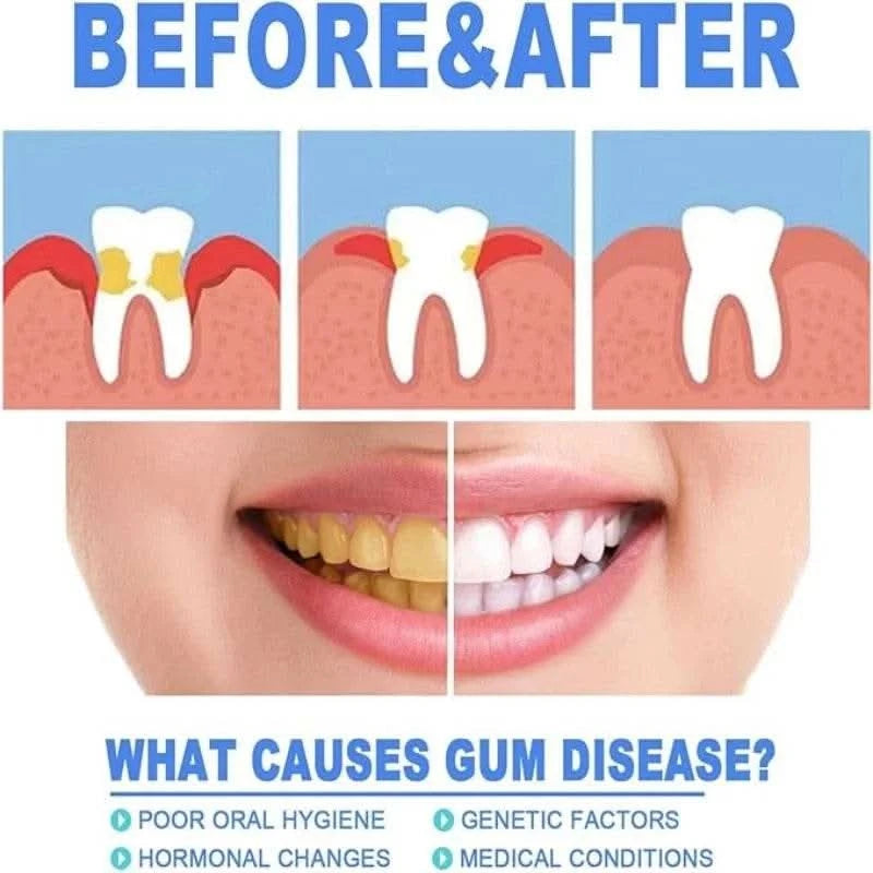 5-Pack Dental Repair Gel Relieves Inflamed Gums and Reduces Bad Breath Deep Clean Tooth Dirt Care Gums Fresh Breath Care Gel - M & M Global