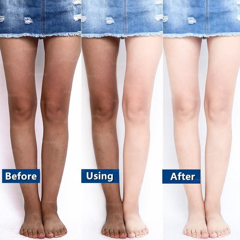 Whitening Cream Fast Whitening Tanning Repair Whole Body Facial Whitening Moisturizing Skin Cleansing Bleaching Remove Darkness - M & M Global