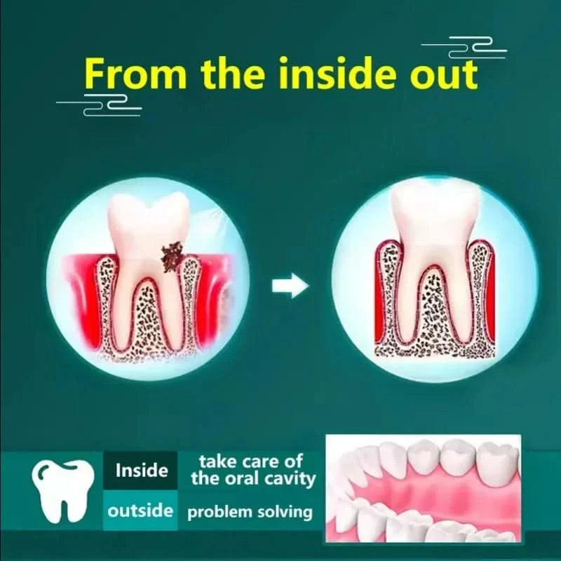 Toothache Spray Swollen Gum Relief Spray Periodontitis Treatment Cure Worms Antiseptic Mouth Tooth Toothpaste Breath Freshener - M & M Global