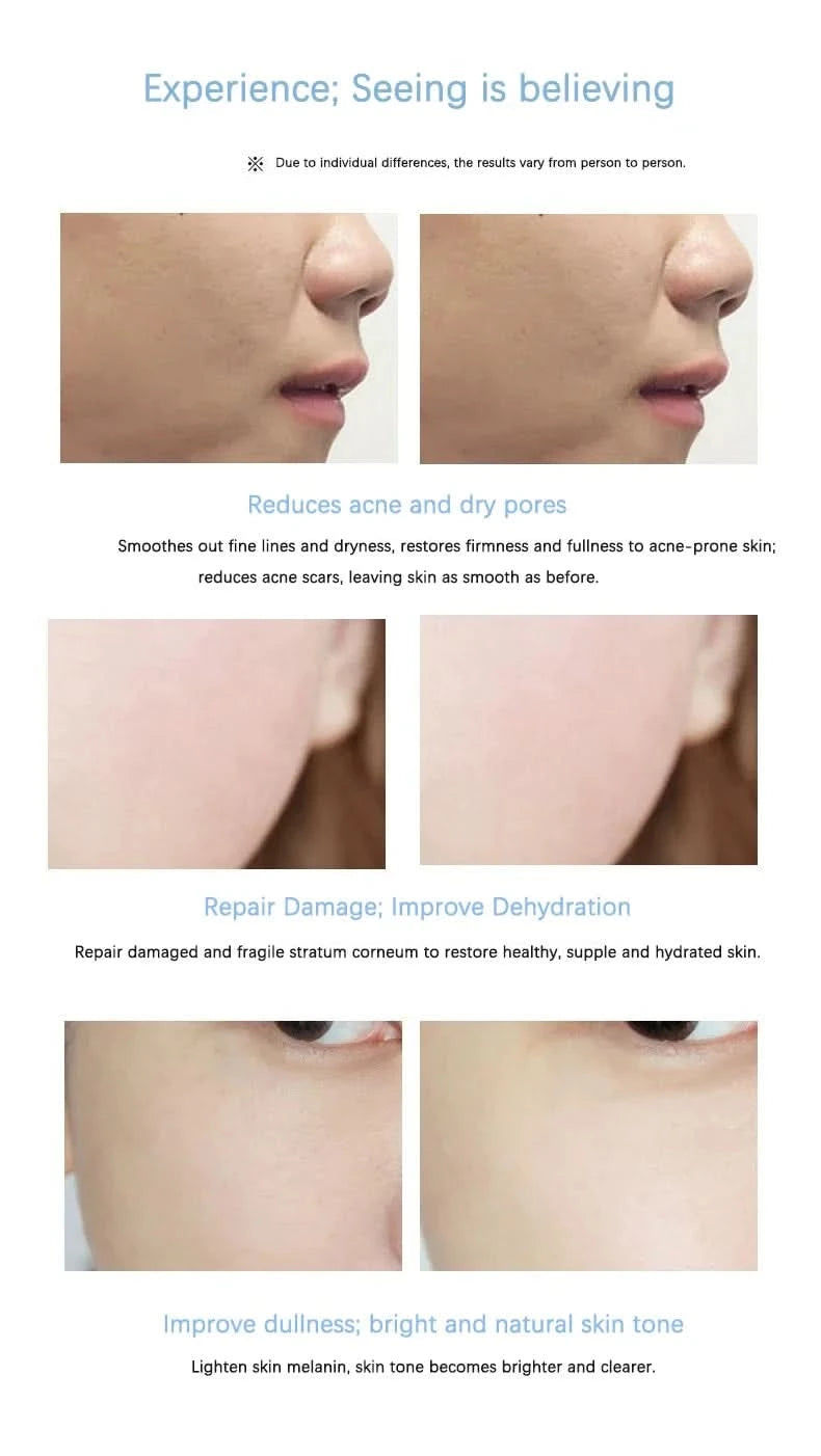 Placenta Freeze-dried Powder Essence Repair Facial Hydrating Nourishing Pore Shrinking Skin Rejuvenate Skin Care - M & M Global