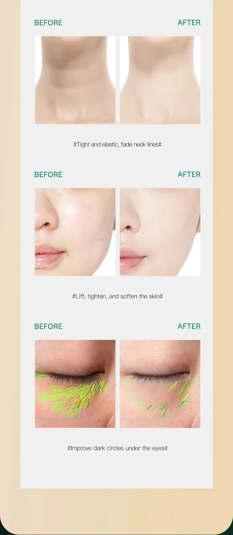 HF Facial Machine All-round Face Massager Neck Facial Eye Lifting Massage Microcurrent Skin Rejuvenation Anti Wrinkle Skin Care - M & M Global