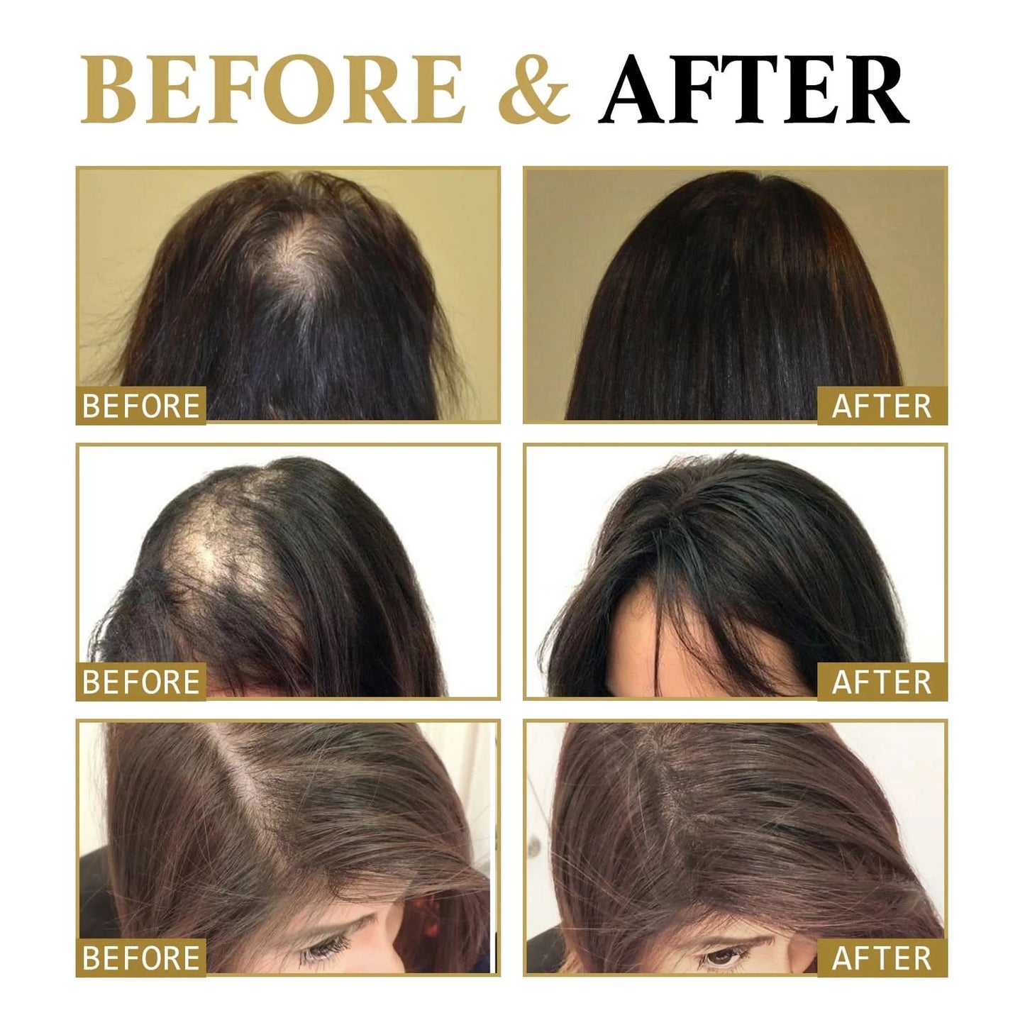 Hair Growth Essential Loss Regrowth Treatment Strengthens Hair Nourishes Scalp Light Weight Non Greasy Improve Scalp Circulation - M & M Global
