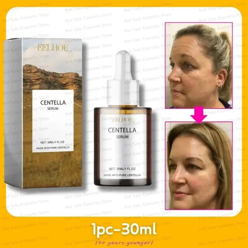 Korean Centella Asiatica Face Serum Nourish Dry Skin Smoothing Rejuvenation Skin Brightening Whitening Cream Facial Moisturizer - M & M Global