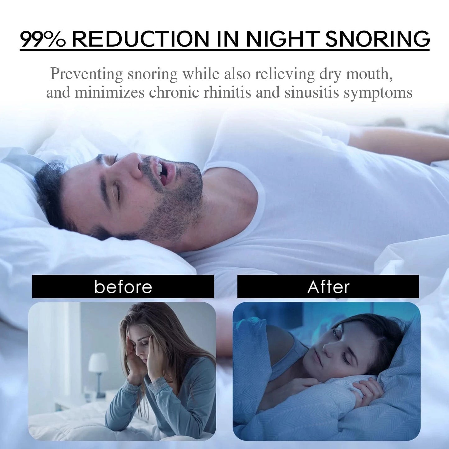 Stop Snoring Patch Nose Breathing Correction Promoting Better Breath Improve Sleeping Portable Night Sleep Mouth Orthosis Tape - M & M Global