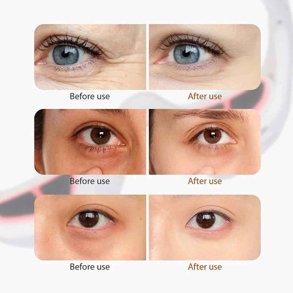 Eye Massager Relieves Eye Fatigue Eyes Massage Glasses Eye Fatigue Relief Massager dropshipping - M & M Global