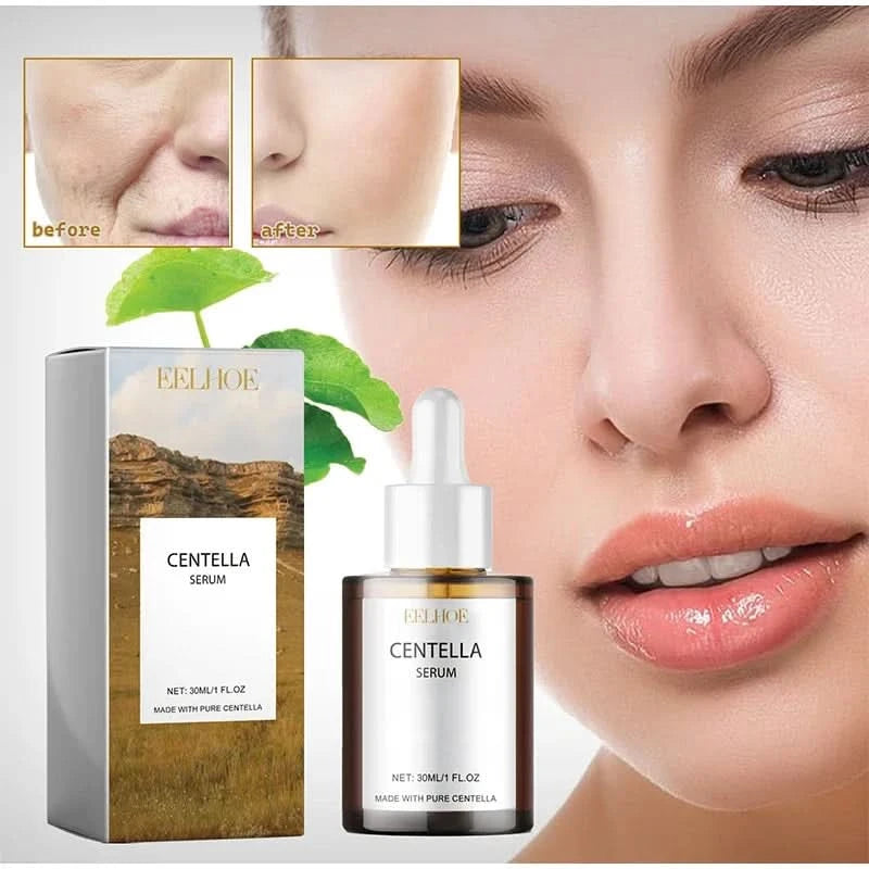 Korean Centella Asiatica Face Serum Nourish Dry Skin Smoothing Rejuvenation Skin Brightening Whitening Cream Facial Moisturizer - M & M Global