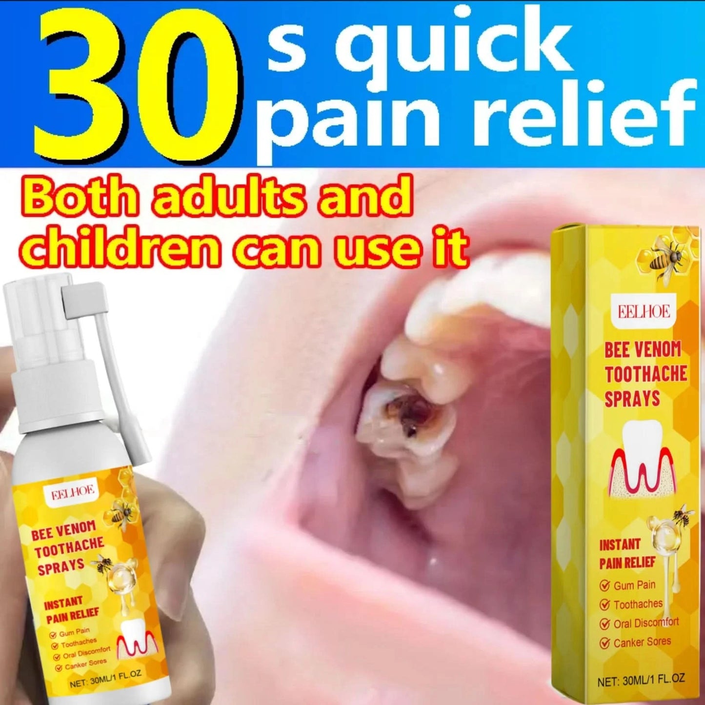 Toothache Spray Swollen Gum Relief Spray Periodontitis Treatment Cure Worms Antiseptic Mouth Tooth Toothpaste Breath Freshener - M & M Global