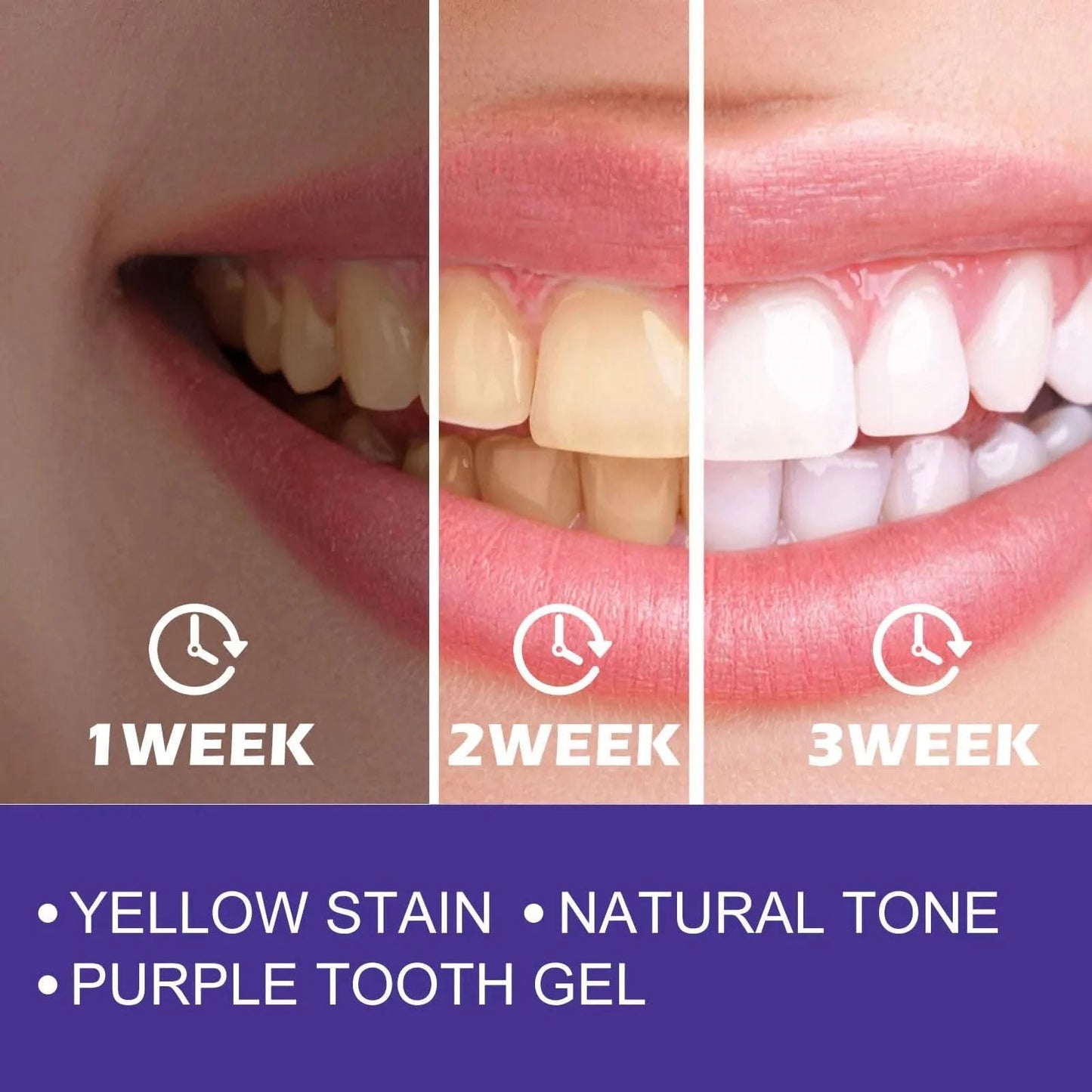 Advanced Teeth Whitening Toothpaste For Oral care, Cavity Treatment And Teeth Whitening in Weeks. For Adults’ Dental Health - M & M Global