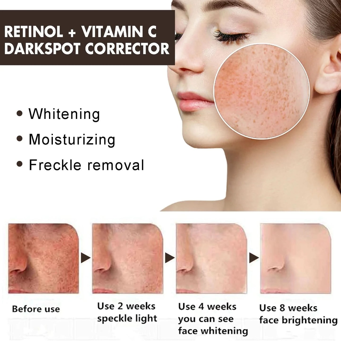 Women Fade Melasma Cream Lightening Dull Brightening Emulsion Remove Dark Stains Brighten Cream Dark Skin Moisturize Products - M & M Global
