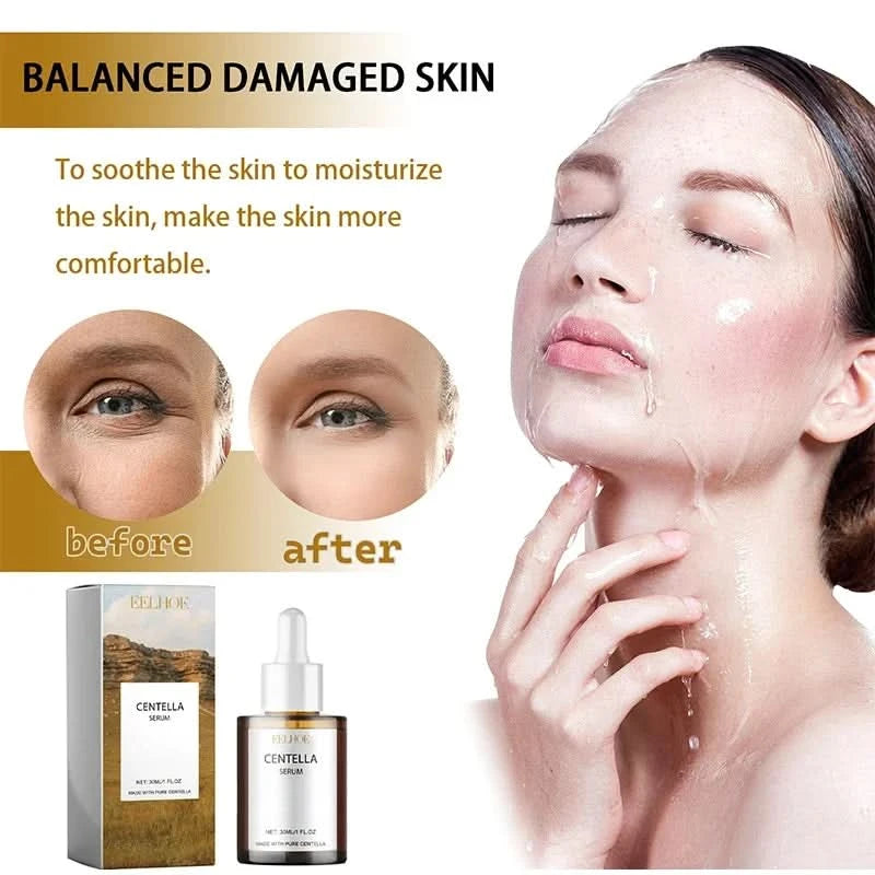 Korean Centella Asiatica Face Serum Nourish Dry Skin Smoothing Rejuvenation Skin Brightening Whitening Cream Facial Moisturizer - M & M Global