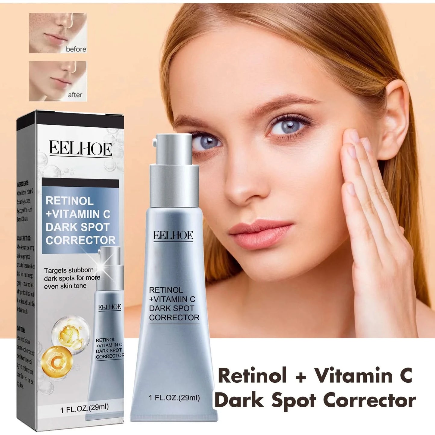 Women Fade Melasma Cream Lightening Dull Brightening Emulsion Remove Dark Stains Brighten Cream Dark Skin Moisturize Products - M & M Global