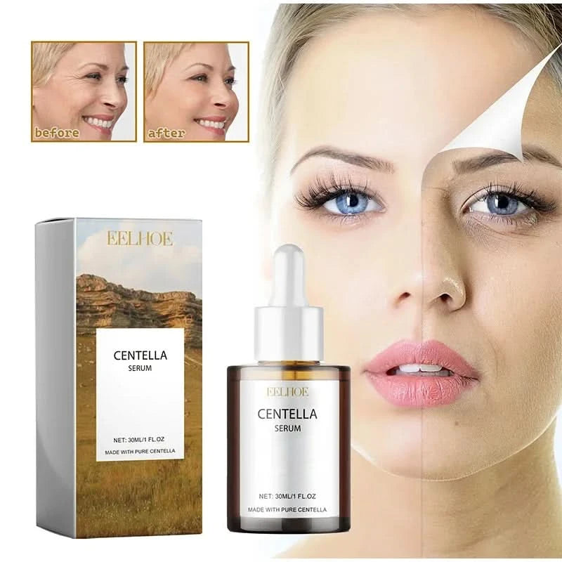 Korean Centella Asiatica Face Serum Nourish Dry Skin Smoothing Rejuvenation Skin Brightening Whitening Cream Facial Moisturizer - M & M Global