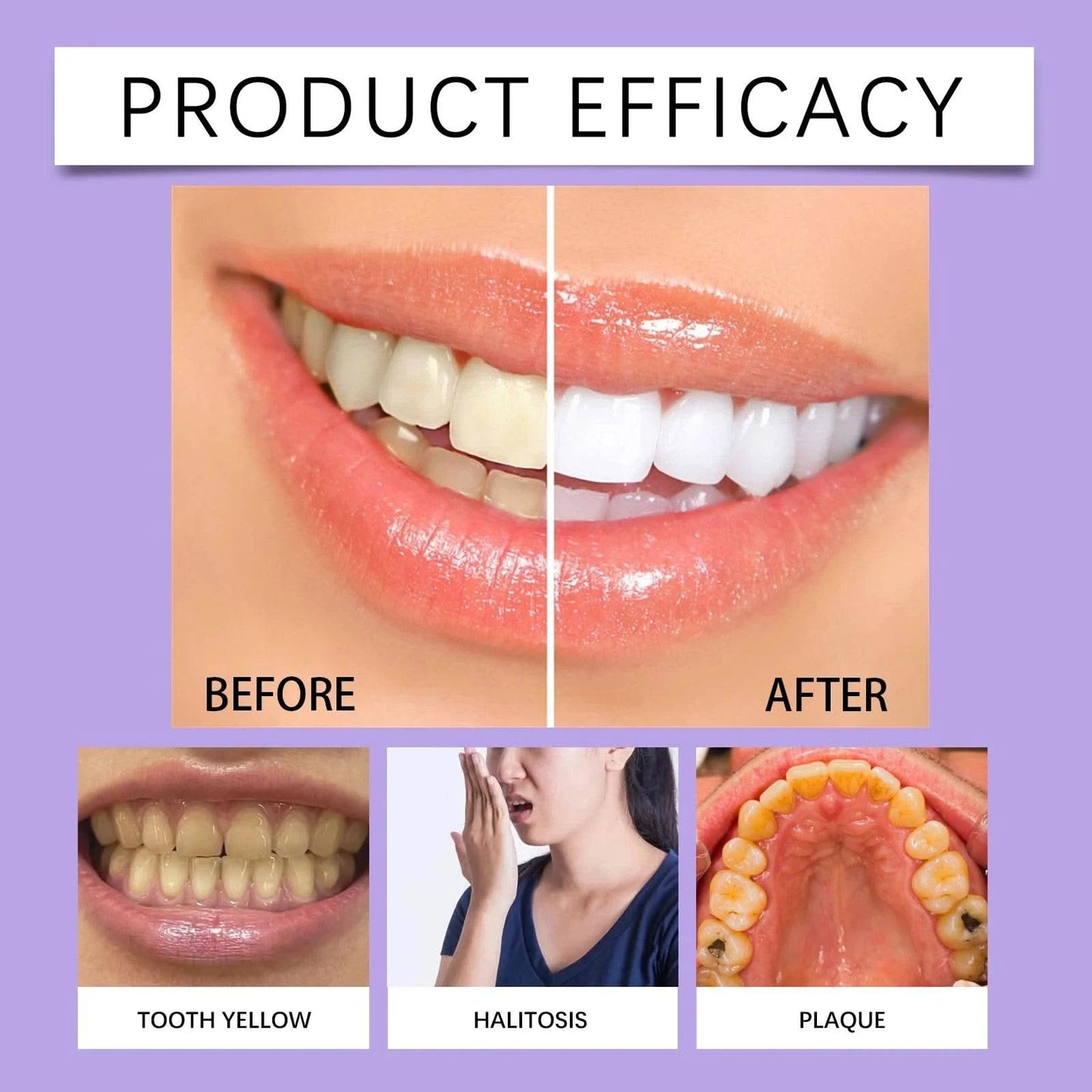 6ml Teeth Whitening Pen Teeth Gel Whitener Bleach Remove Stains Oral Hygiene Instant Smile Teeth Whitening Cleansing Serum - M & M Global