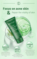 BREYLEE Acne Treatment Set 4pcs Facial Cleanser Toner Serum Cream Skin care - M & M Global