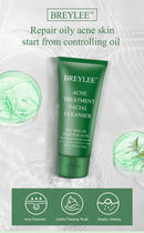 BREYLEE Acne Treatment Set 4pcs Facial Cleanser Toner Serum Cream Skin care - M & M Global