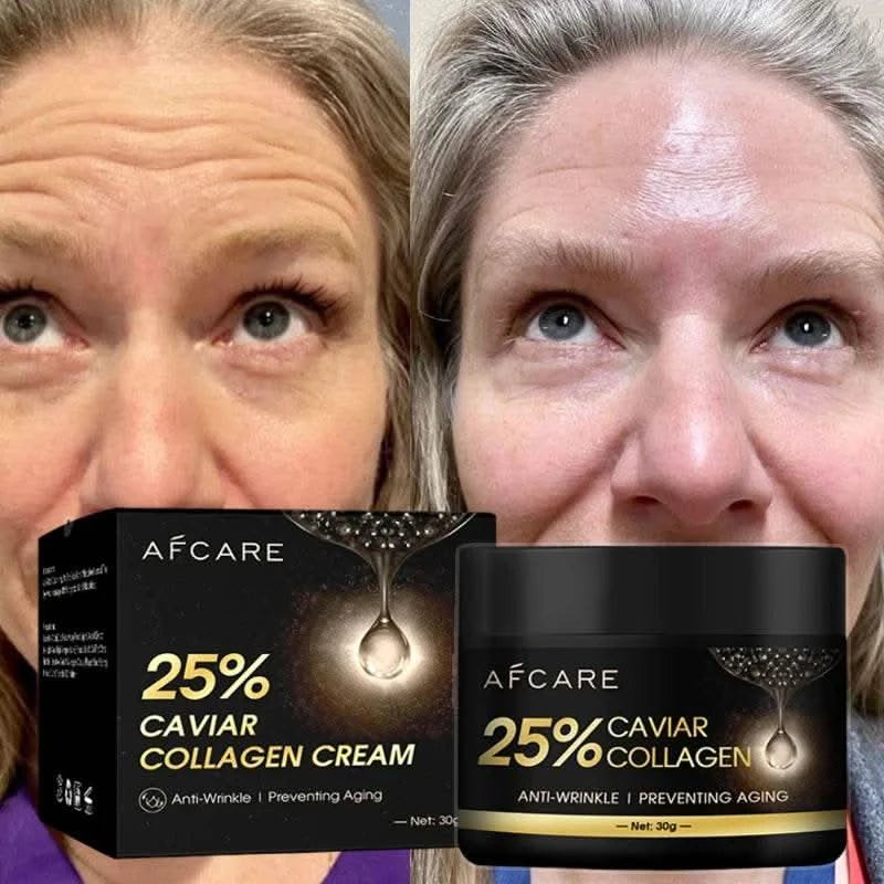 Caviar Wrinkle Remover Face Cream Free Eye Mask Collagen Lifting Firming Fade Fine Lines Anti-aging Moisturizing Korean Cosmetic - M & M Global
