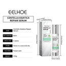 Face Essence of Centella Asiatica Moisturizing Facial Serum Brighten Smooth Skin Care Rejuvenation Pore Refining Resurfacing - M & M Global