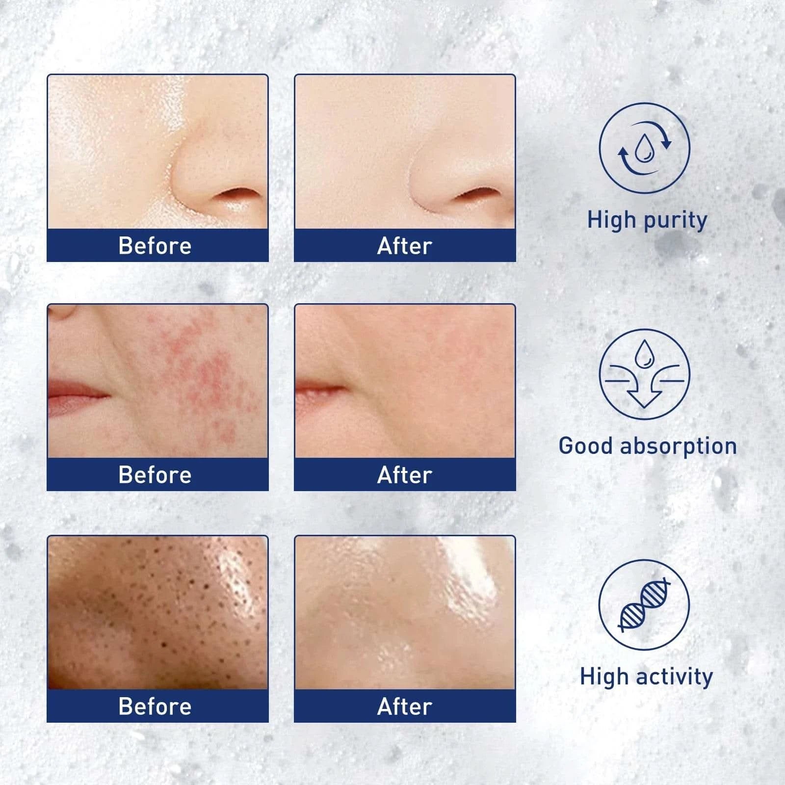 60ml Exfoliating Mousse Purifying Pores Temperate Clean Oil Control Exfoliator Blackhead Dead Skin Convenient Cleansing Foam - M & M Global