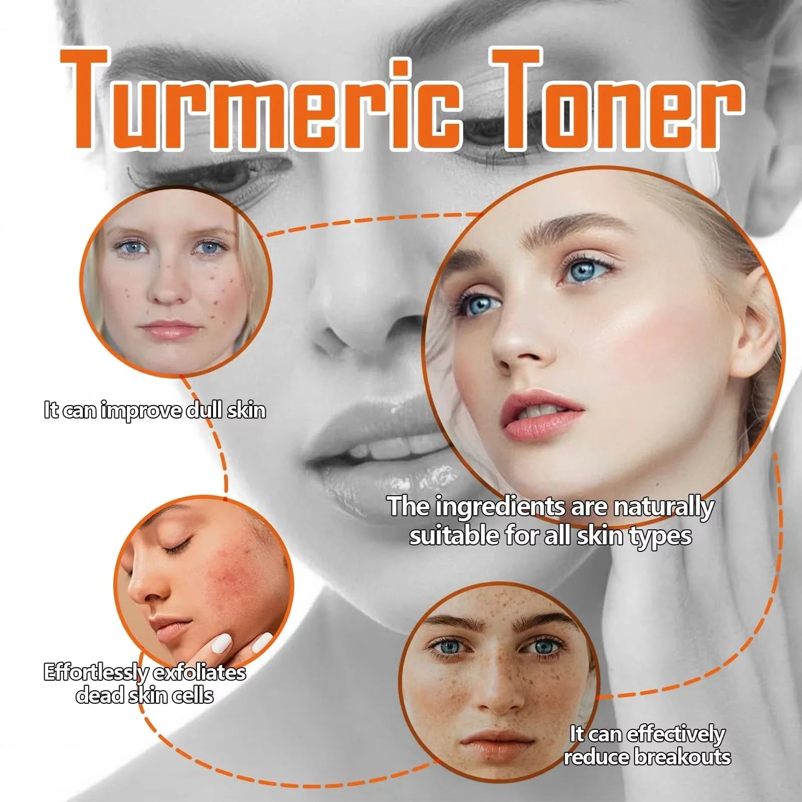 West&Month 100ml Dark Spots Removal Toner Turmeric Deep Hydration Lighten Melasma Remove Freckle Moisturizing Facial Skin Toner - M & M Global