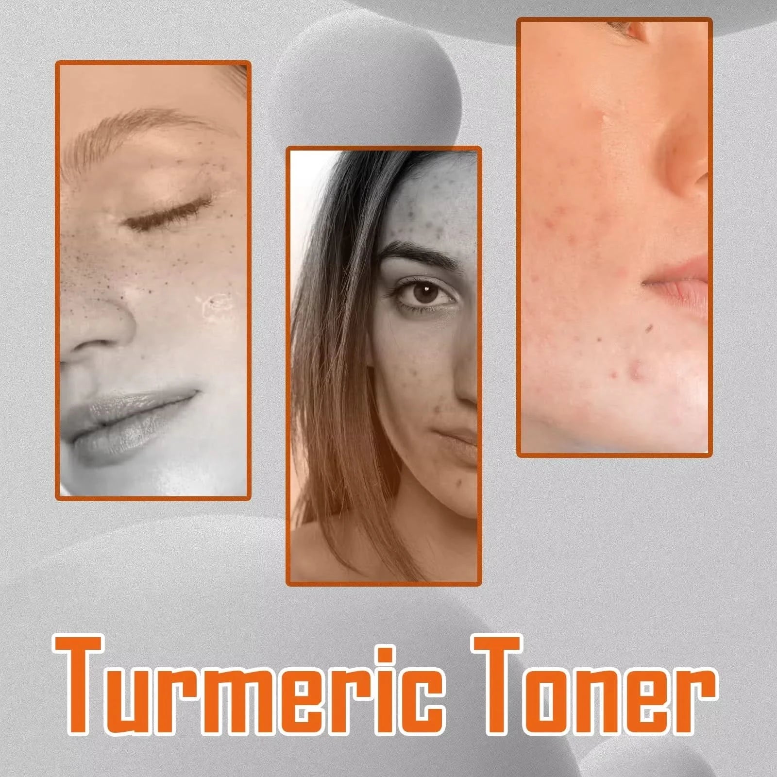 West&Month 100ml Dark Spots Removal Toner Turmeric Deep Hydration Lighten Melasma Remove Freckle Moisturizing Facial Skin Toner - M & M Global