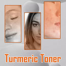 West&Month 100ml Dark Spots Removal Toner Turmeric Deep Hydration Lighten Melasma Remove Freckle Moisturizing Facial Skin Toner - M & M Global