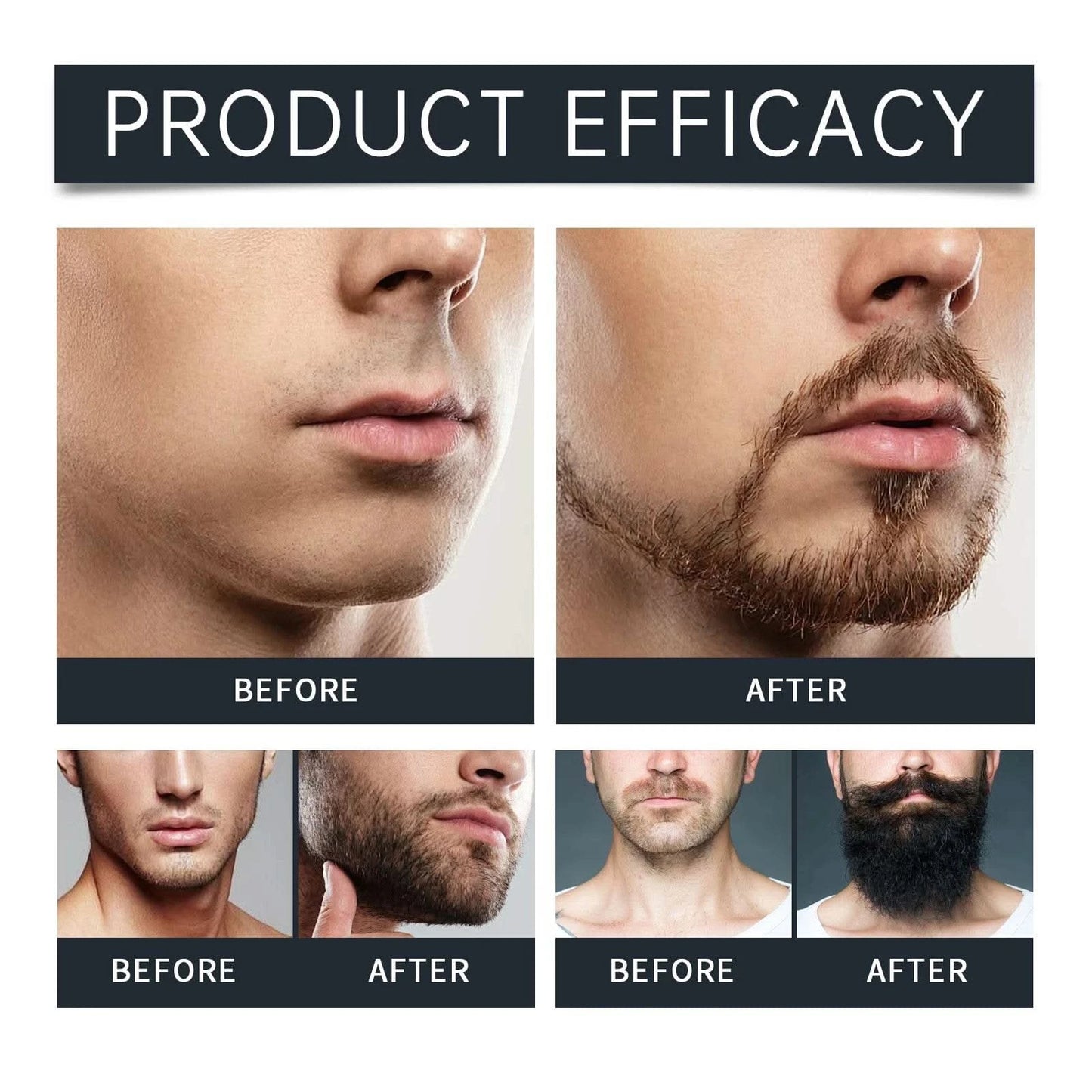East Moon Men Beard Care Set for Cleaning Strengthen Nourishing Beard Promote Beard Growth Moisturizing Men Whisker Care Set - M & M Global