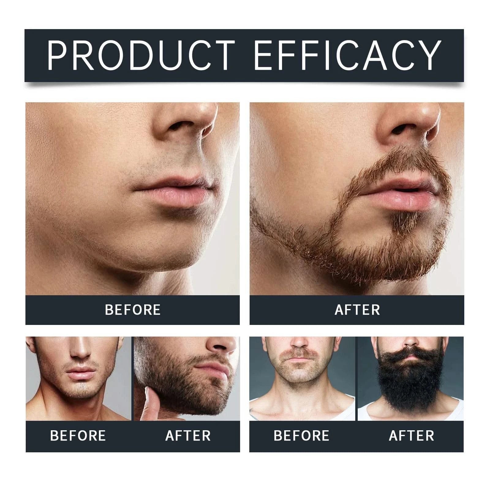 East Moon Men Beard Care Set for Cleaning Strengthen Nourishing Beard Promote Beard Growth Moisturizing Men Whisker Care Set - M & M Global