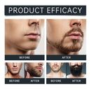 East Moon Men Beard Care Set for Cleaning Strengthen Nourishing Beard Promote Beard Growth Moisturizing Men Whisker Care Set - M & M Global