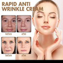 Hoygi 50ml Rapid Anti Wrinkle Cream Instant Remove Wrinkles Fine Line Moisturize Firming Face Hydrating Brightening Facial Cream - M & M Global