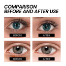West Month Anti-aging Eye Cream Fade Fine Line Reduce Under Eye Bags Remove Dark Circles Hydrating Firming Lifting Eye Cream - M & M Global