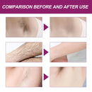 Oceaura Hair Removal Spray Painless Quick Smoothing Skin Silky Beauty Body Delay Growth Hair Removal Mist for Armpit Leg Bikini - M & M Global