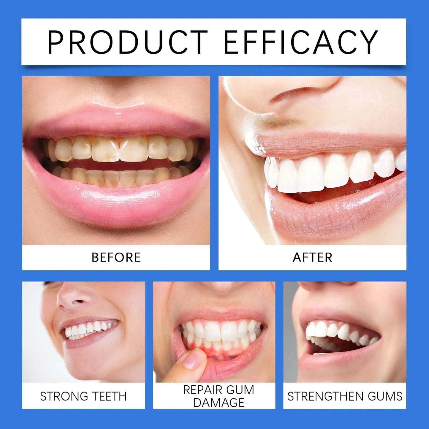 Oralhoe Beauty Teeth Mouthwash Daily Oral Care Remove Food Residues Remove Bad Breaths Prevent Decay Dental Care Mouthwash - M & M Global