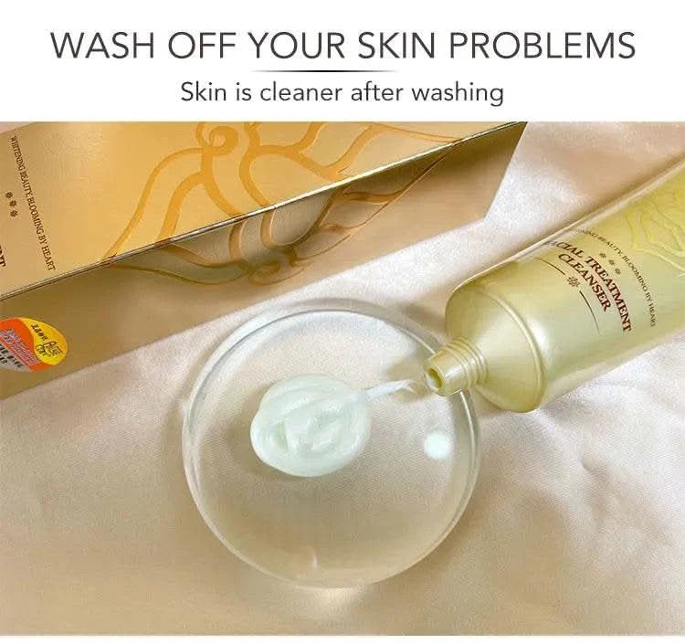 AILKE Whitening Remove Black Spots Facial Cleanser Refreshing Foaming Oil Control Non-irritating With Amino Acid Women Face Care - M & M Global
