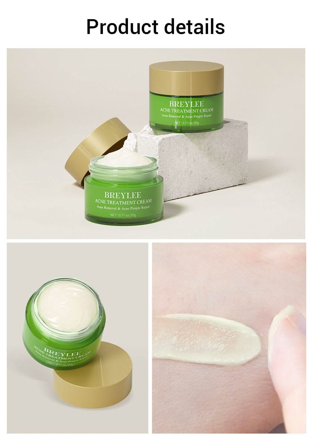 BREYLEE Acne Treatment Set 4pcs Facial Cleanser Toner Serum Cream Skin care - M & M Global