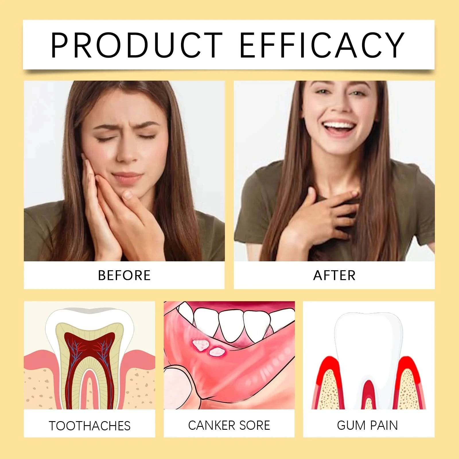 Toothache Spray Swollen Gum Relief Spray Periodontitis Treatment Cure Worms Antiseptic Mouth Tooth Toothpaste Breath Freshener - M & M Global