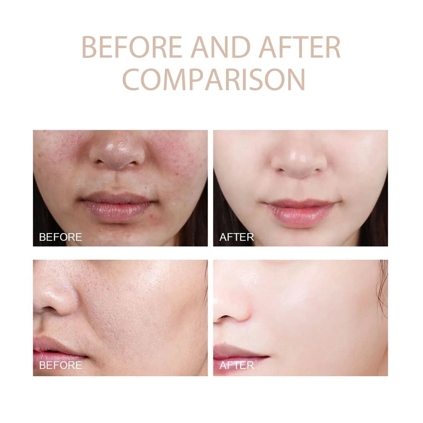 Face Deep Cleaning Exfoliating Gel Skin Care Whitening Moisturizer Repair Facial Scrub Skin Care 50g - M & M Global
