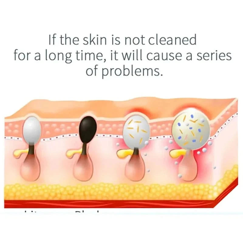 Face Beauty Device 2 In1 Pore Vacuum Cleaner Electric Micro Small Bubble Facial Cleaning Machine Skin Rejuvenation Sprayer Spa - M & M Global