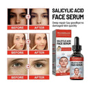 Niacinamide Facial Serum Salicylic Acid Moisturizing Skin Care Products 2024 - M & M Global