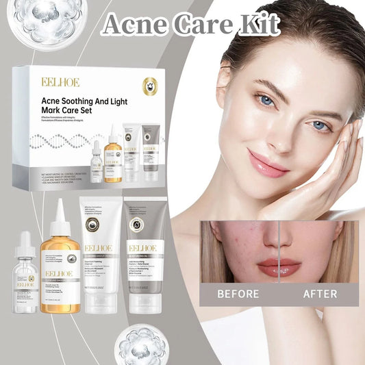 Acne Care Kit Brightening Skin Tone Fade Acne Scars Improving Skin Texture Deeply Moisturizing The Skin Facial Skincare Products - M & M Global