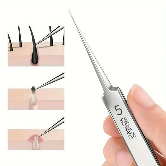 Fine Tip Stainless Steel Acne Clip, Acne Removal Tweezers, Facial Blackhead Extraction Facial Cleansing Skin Care Tools - M & M Global