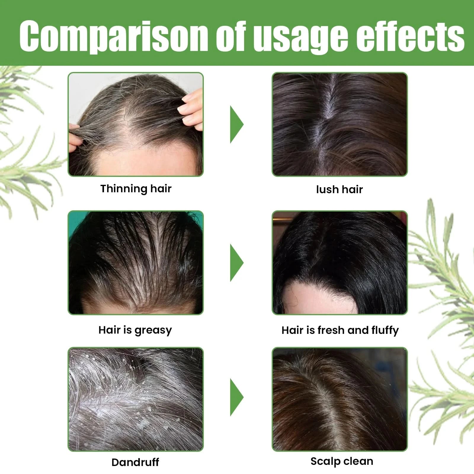 Hair Shampoo For Tinea Capitis Antipuriticprofessional Antidandruff Remove Mites Andrelieve Itching Shampoo 100ml Party Favours - M & M Global