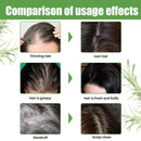Hair Shampoo For Tinea Capitis Antipuriticprofessional Antidandruff Remove Mites Andrelieve Itching Shampoo 100ml Party Favours - M & M Global