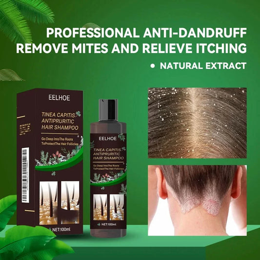 Hair Shampoo For Tinea Capitis Antipuriticprofessional Antidandruff Remove Mites Andrelieve Itching Shampoo 100ml Party Favours - M & M Global