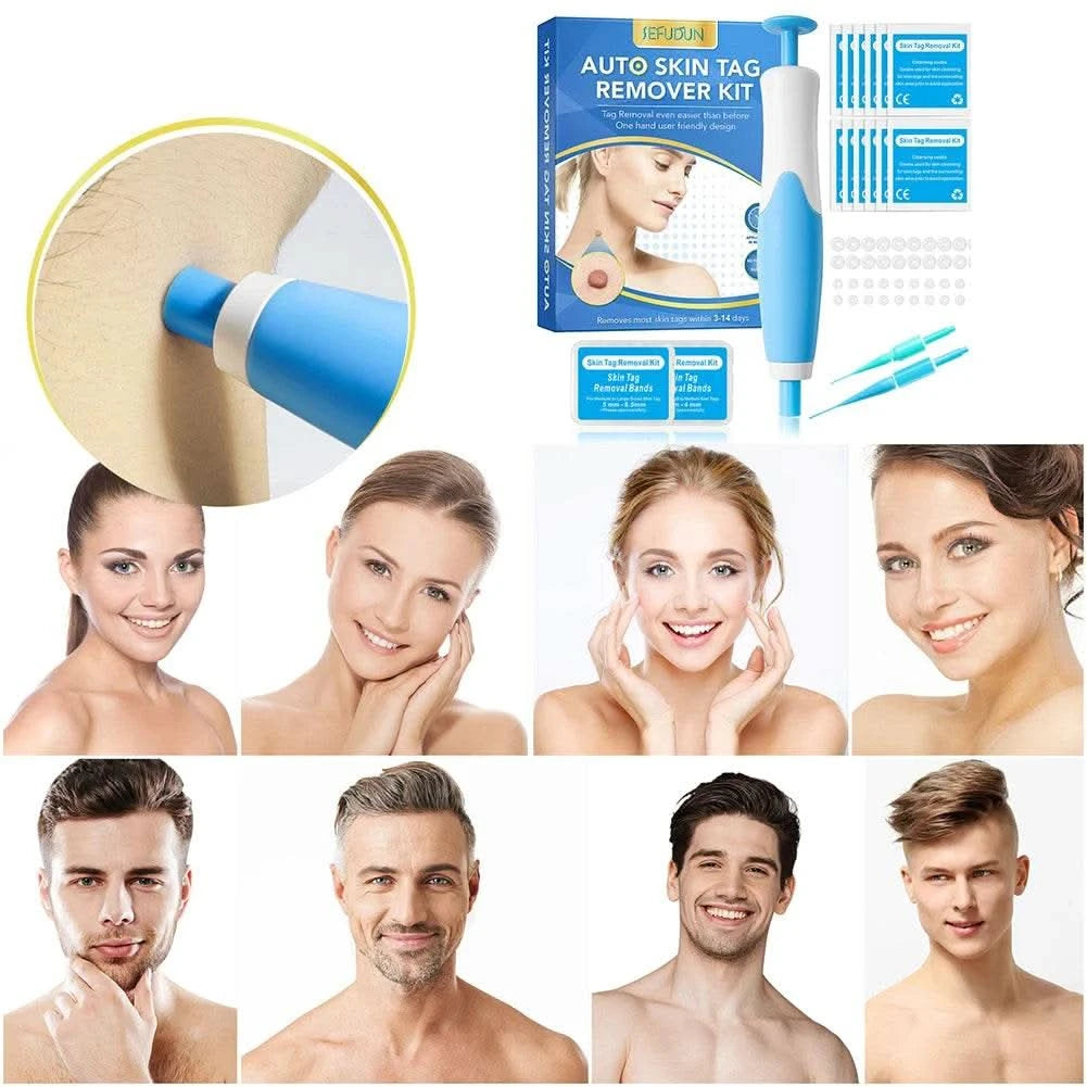 2 IN 1 Auto Micro Skin Tag Remover Device Standard And Micro Skin Tag Removal Kit Adult Mole Wart Remover Face Care Beauty Tools - M & M Global